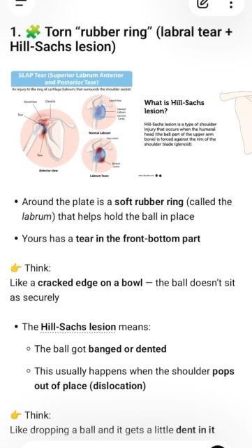 Hey everyone!!
I'm sure a lot of you have received my email regarding whats going on with my shoulder. I thought I'd share an explanation of the results from my MRI.
(I asked chatgpt to put it in simple terms that I could understand!) 🤣😂🤣
Luckily it isn't my pulling arm so not as catastrophic as it could be! I will still be working at decreased capacity and hours until I can have surgery to fix this bad boy up, until then I highly recommend you prebook your appointments as much as possible!
If you have any questions, don't hesitate to reach out!
Thanks for all your love and support!