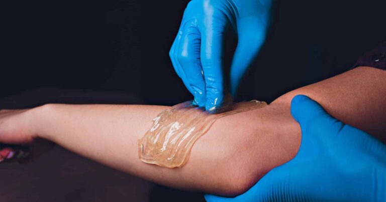 Blue-gloved hands applying sugaring paste for hair removal on arm